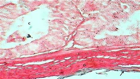  Neodermites: ¡Un Viaje Microscópico por los Intestinos de las Aves!