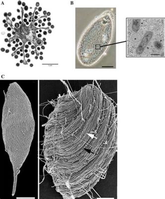 Streblomastix! Un enigmático protista que desafía la clasificación tradicional y presenta una danza hipnótica bajo el microscopio